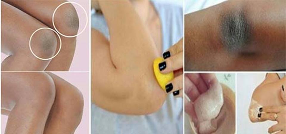 How To Lighten Black Skin Naturally How To Lighten Black Skin Naturally